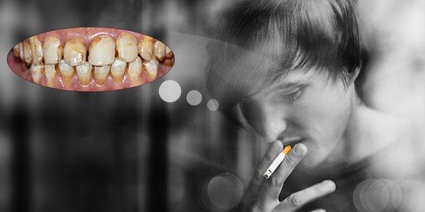Những nguyên nhân khiến răng bị ố vàng và cách khắc phục