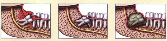 Bệnh về răng Bệnh về răng