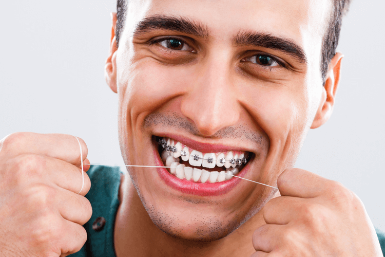 Chăm sóc niềng răng đúng cách Chăm sóc niềng răng đúng cách