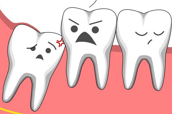 Nên hay không nên loại bỏ răng khôn