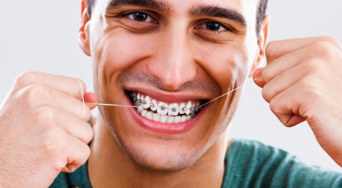 Chăm sóc răng miệng đúng cách trong suốt quá trình niềng răng
