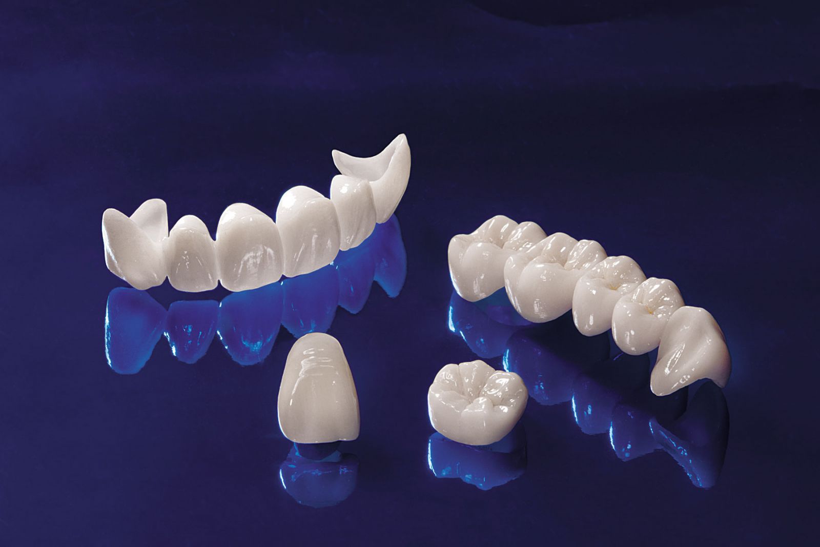 Những điều cần biết về bọc răng sứ Cercon HT